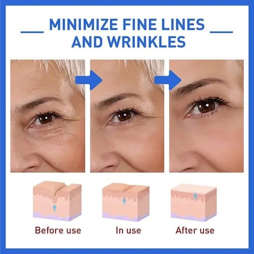 SkinKart® | Botox Skin Tightening Young Serum