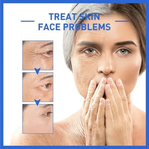 SkinKart® | Botox Skin Tightening Young Serum