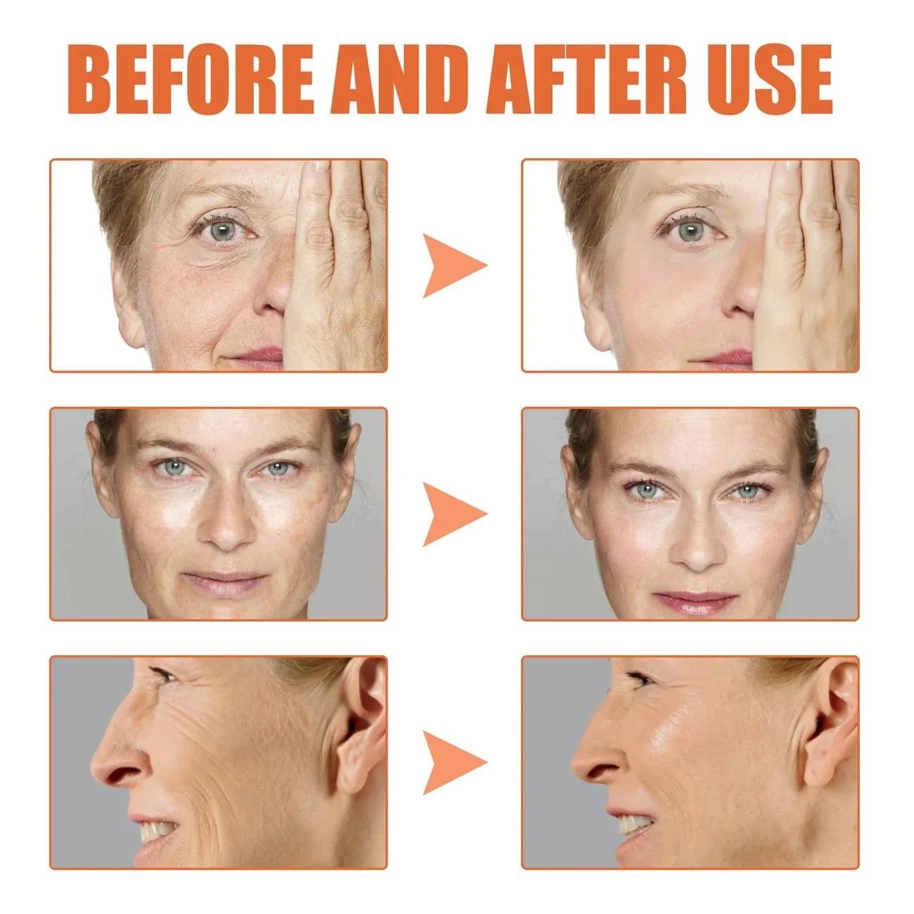 SkinKart® | Botox Skin Tightening Young Serum