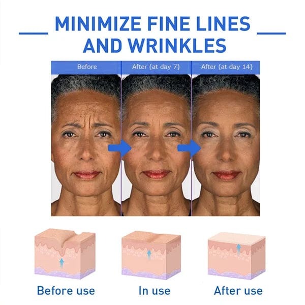 SkinKart® | Botox Skin Tightening Young Serum